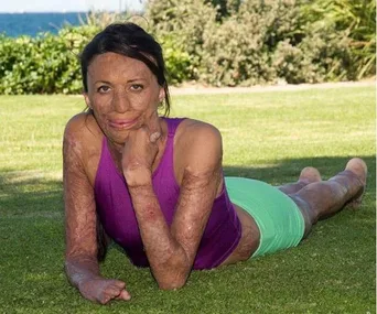Turia Pitt ironman world championship
