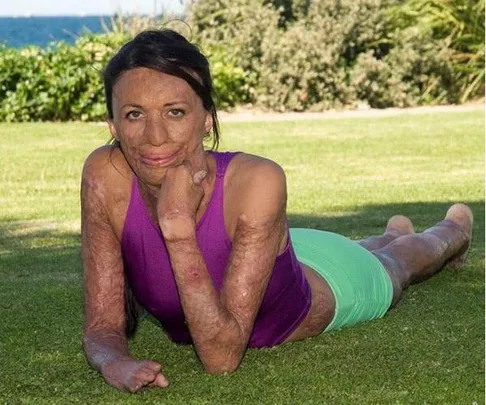 Turia Pitt ironman world championship