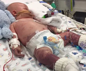 ‘Meningococcal hit my son like a wrecking ball’: Parents’ heartache over sick son