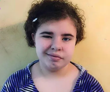 Young cancer survivor takes her own life after being bullied about her nerve-damaged face