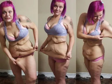The thing no one tells you about losing weight