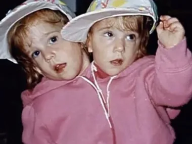 Conjoined twins Abby and Brittany Hensel: where are they now?