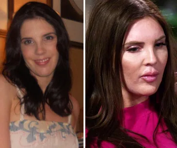 Tracey Jewel Married At First Sight plastic surgery