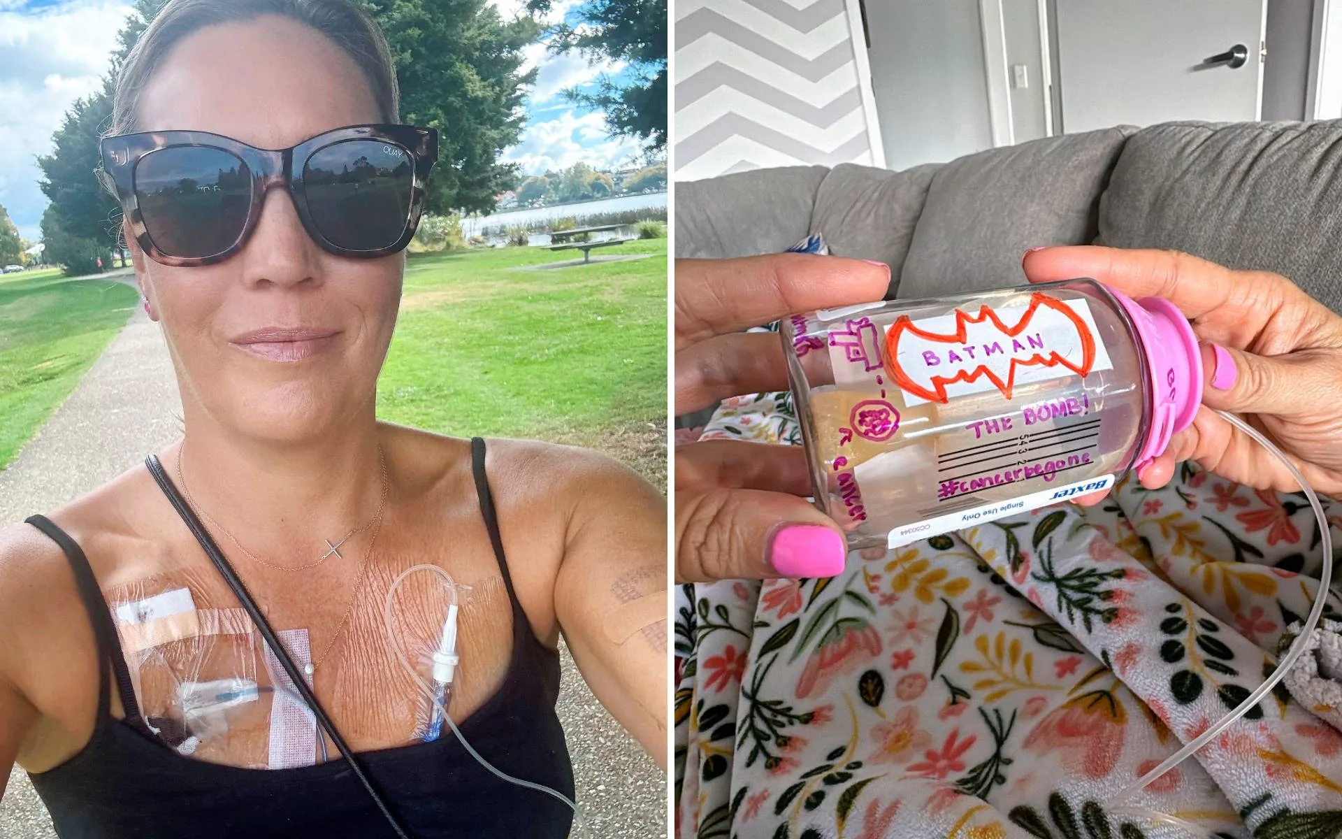 Two images side by side. One is a selfie of Jackie walking outside while her chest is covered in tubes and plasters, and the other is of her medication bottle covered in writing about beating cancer