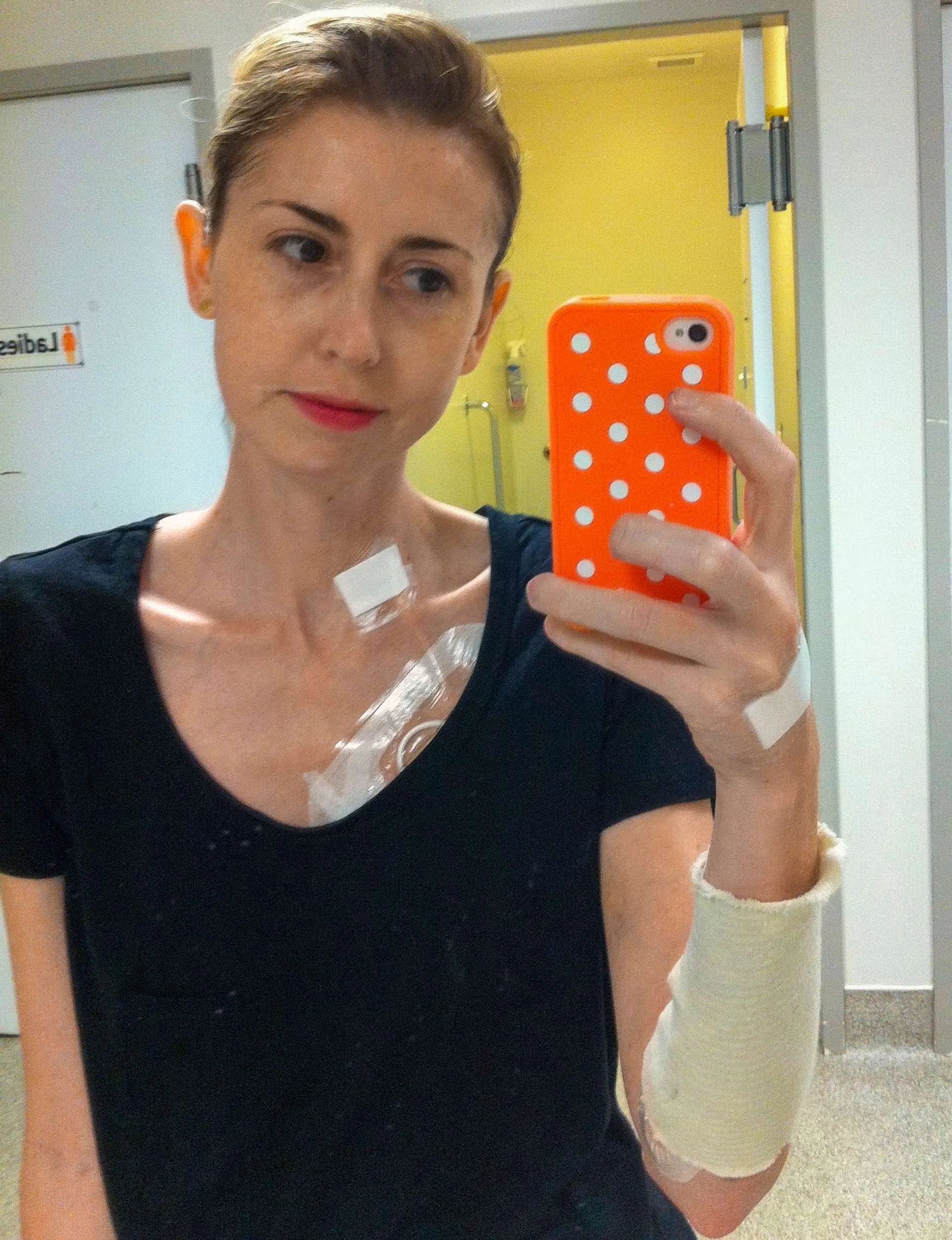 A selfie in the hospital mirror while covered in bandages and tubes