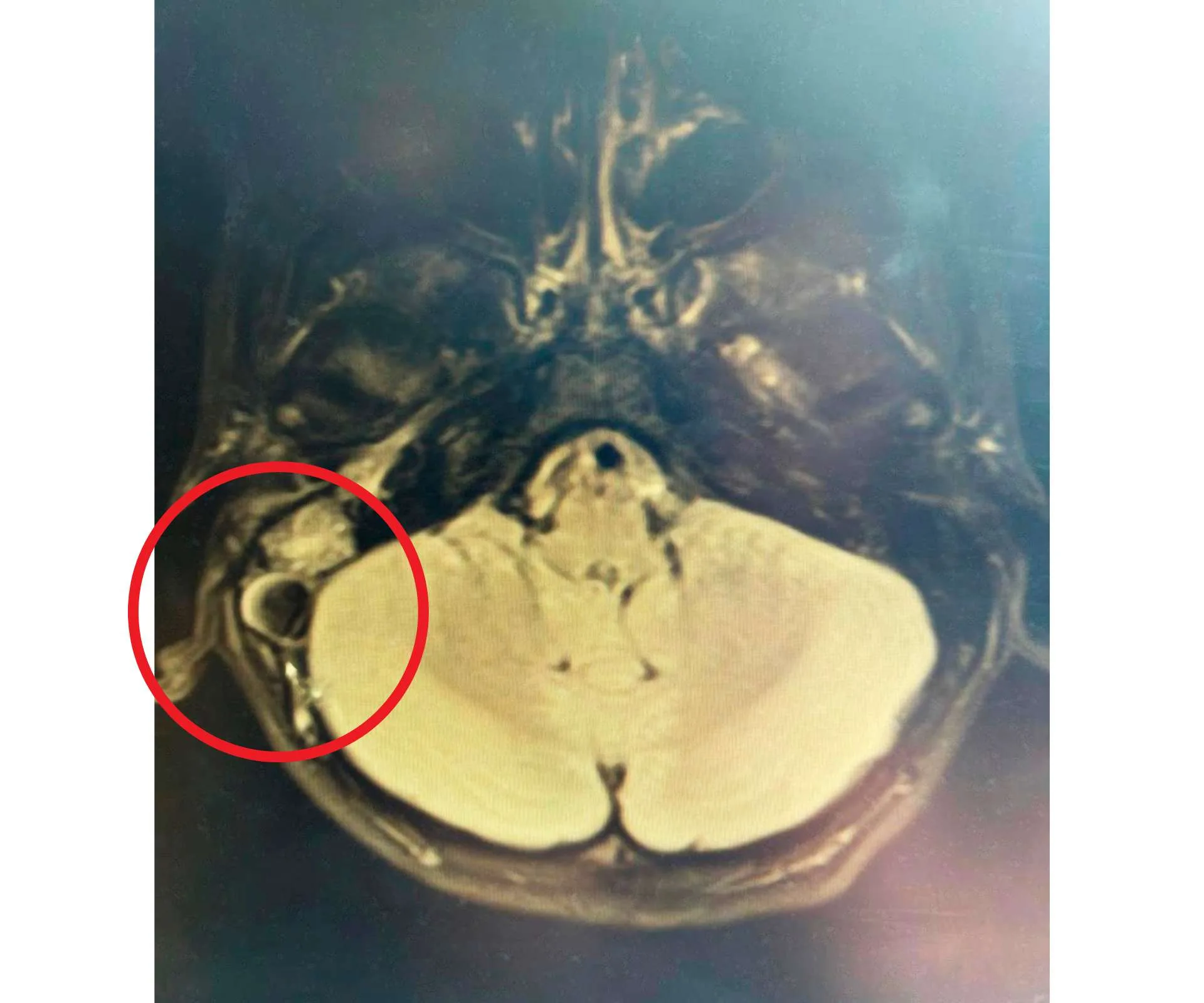 The scan of Cole's brain