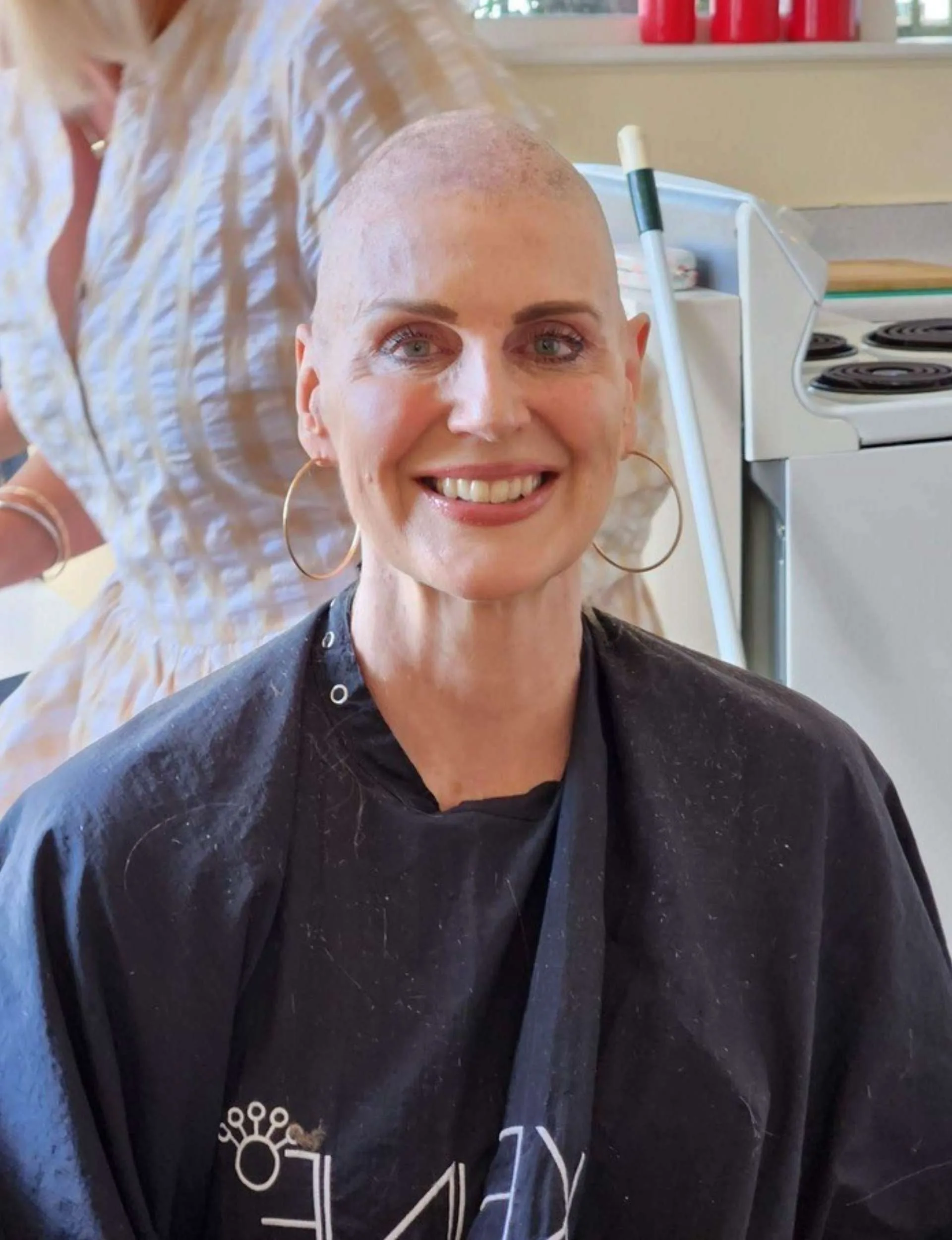 Caro McCourtie after shaving her head
