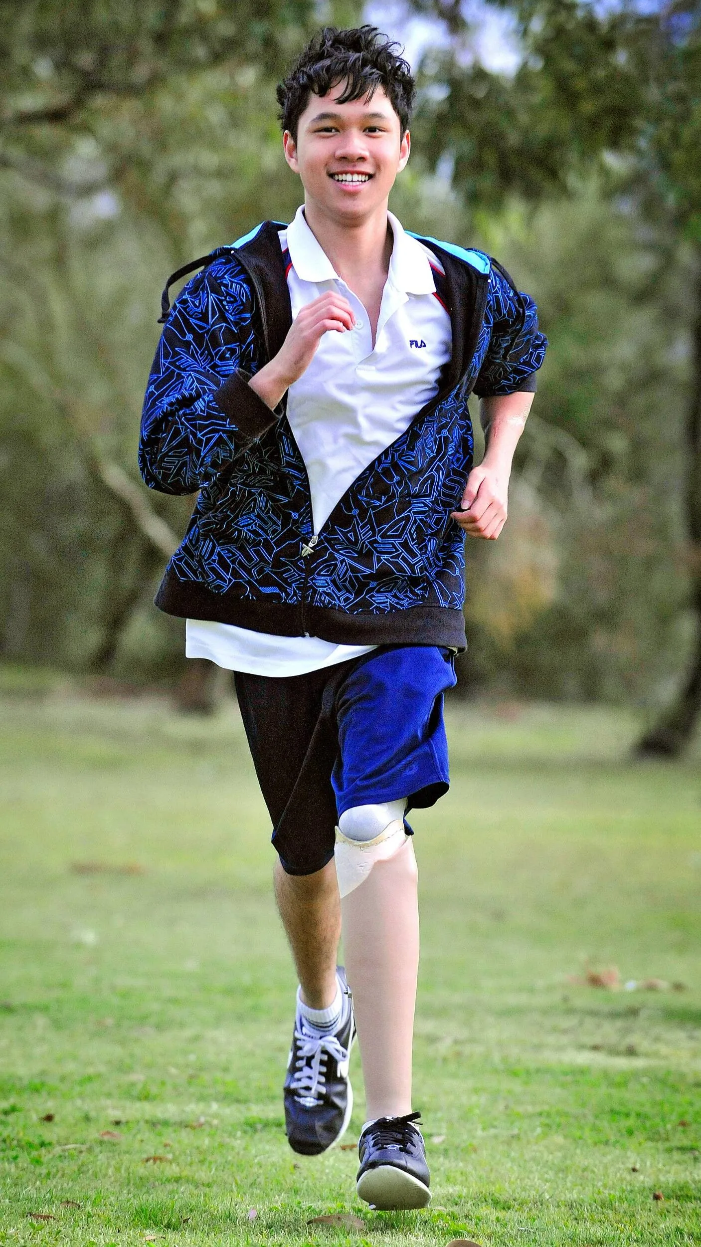 Terry Vo running with a prosthetic leg
