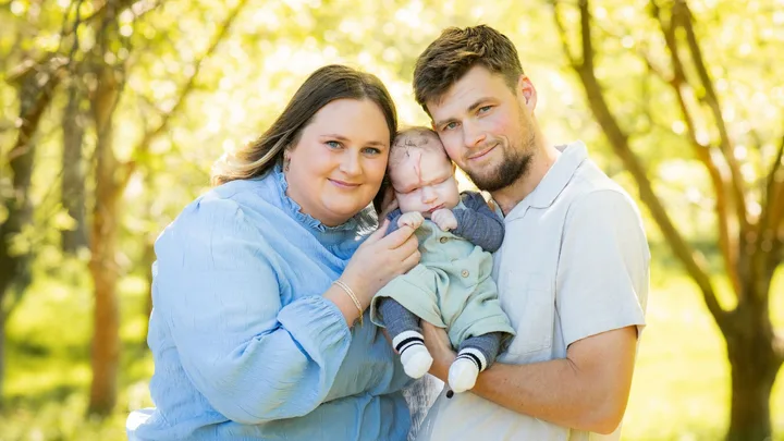 Timaru parents share their son’s incredible fight with amniotic band syndrome