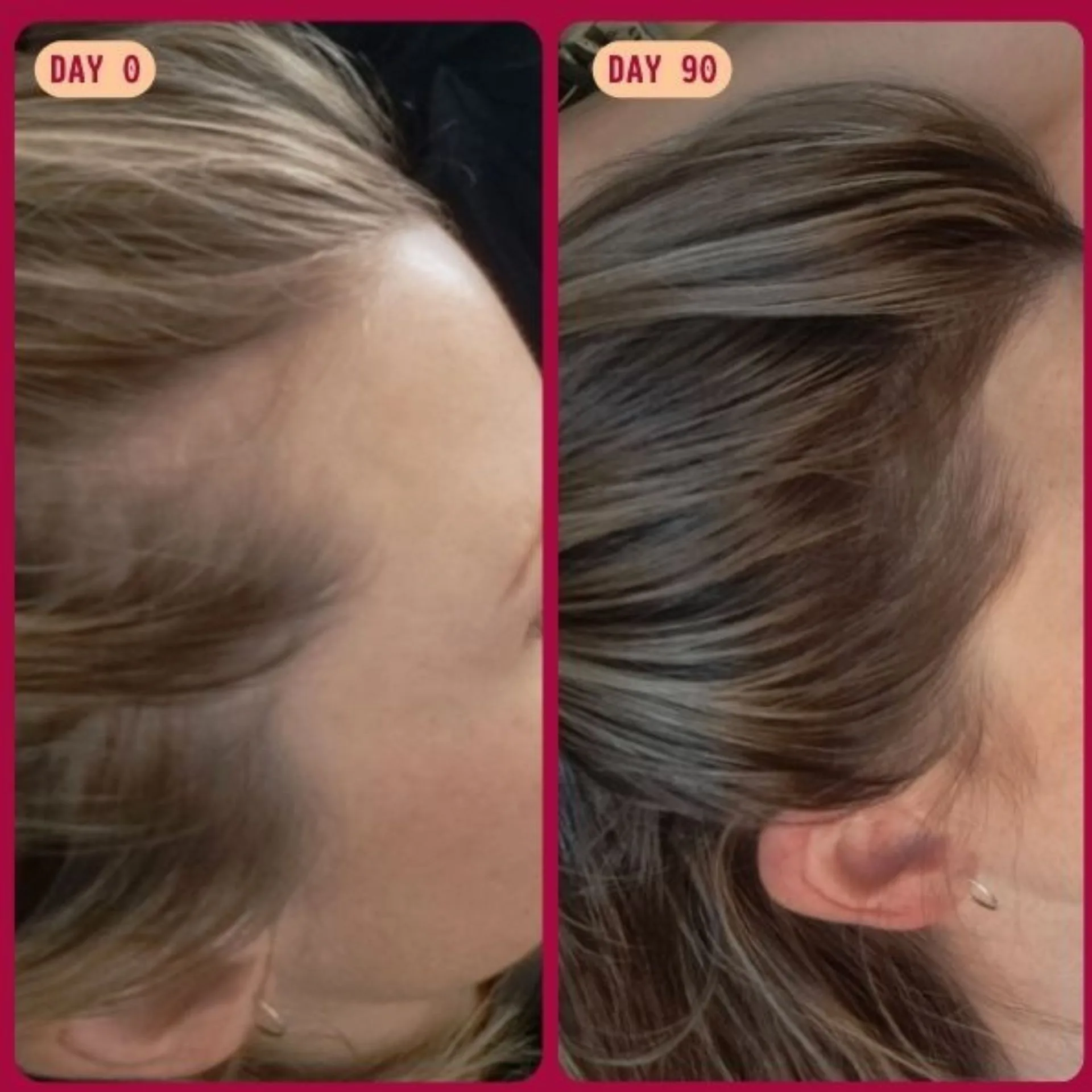 Before and after of hair growth