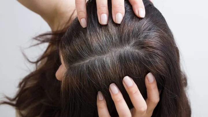 Noticing thinning strands? A hair expert explains the secret within your roots