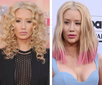 Iggy Azalea confirms she had a nose job: ‘Denying it is lame’