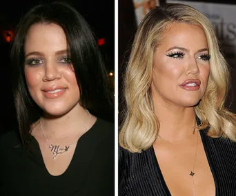 Nip-tuck tales! Shocking plastic surgery transformations