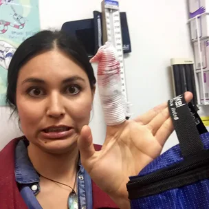 Nadia Lim recovering after kitchen mishap
