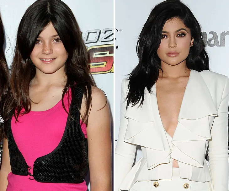 Keeping up with Kylie Jenner&rsquo;s ever-changing face