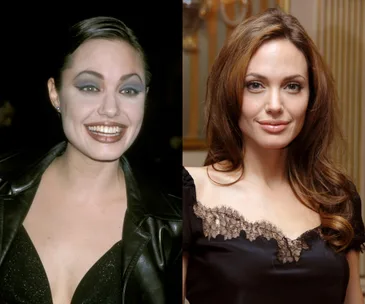 Best celebrity makeunders