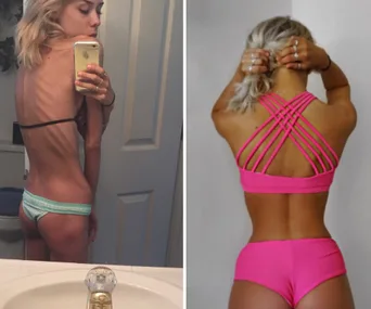 Woman who once weighed 28kgs shares inspirational before and after photos