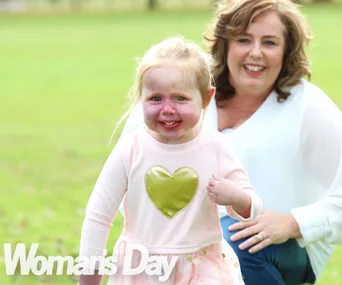 Kiwi family trying to raise $200,000 to save daughter’s face