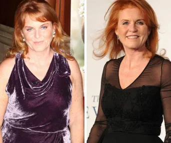 Weight Watchers is axing before and after photos