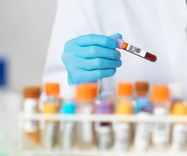 New blood test can detect autism in children much earlier