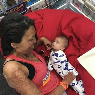 Turia Pitt shares more adorable motherhood pictures