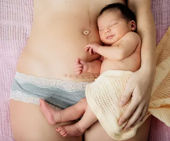 This is what a REAL post-baby body looks like