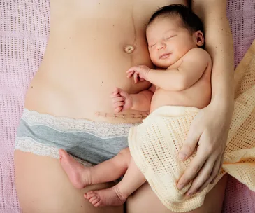This is what a REAL post-baby body looks like