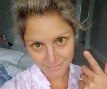 Toni Street liver injury