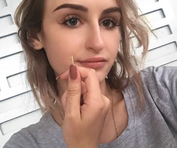 Kiwi teen’s bizarre diagnosis: ‘You have a plant growing in your ear’