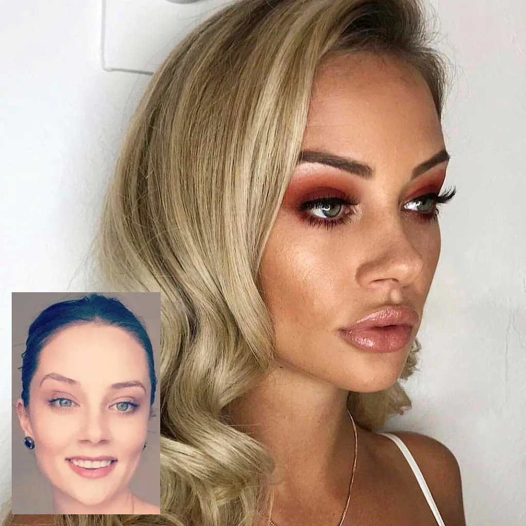 Married at First Sight brides plastic surgery transformations(03)