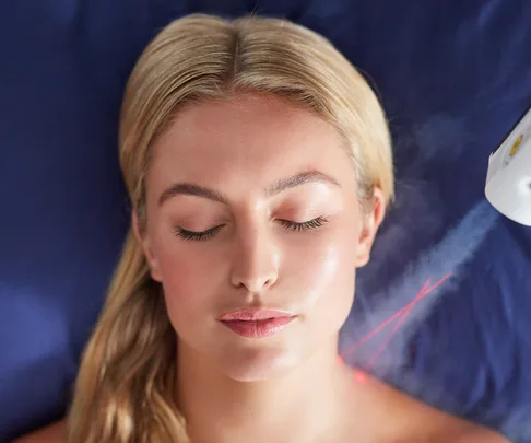 Cryotherapy treatment