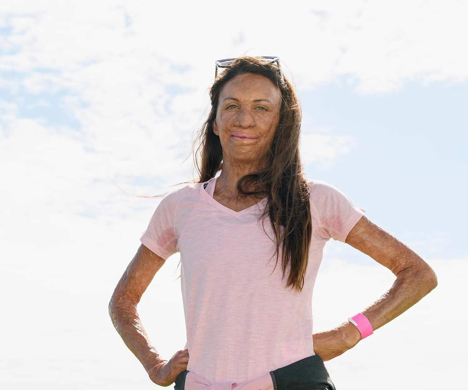 Australian burns survivor Turia Pitt and partner Michael Hoskin have welcomed their second baby