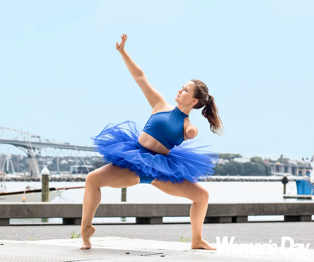 One-armed Kiwi dancer Brylee Mills reveals why her disability won’t stop her