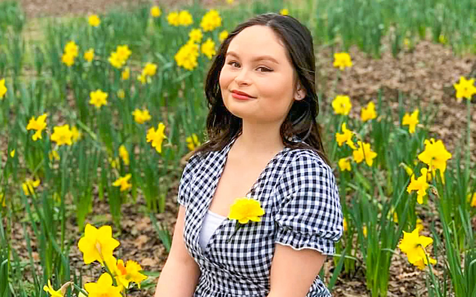 Dancer’s devastating discovery ‘My sore shoulder was cancer’