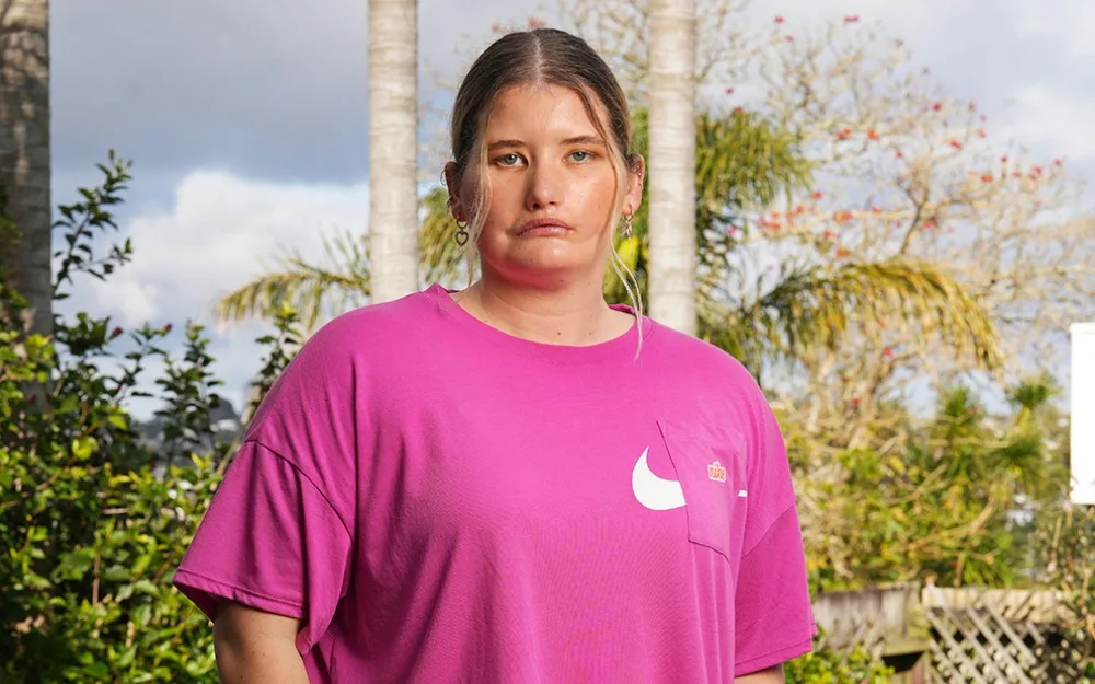 The girl who can’t smile: ‘There isn’t anyone like me’