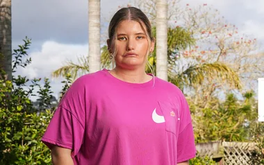 The girl who can’t smile: ‘There isn’t anyone like me’