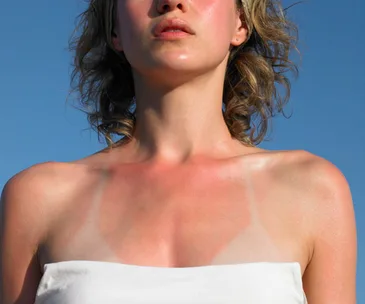 Saving ourselves from melanoma