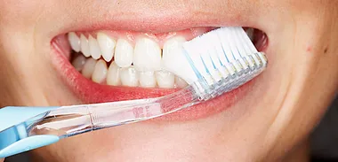prevent-tooth-decay