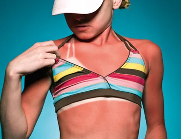 Here comes the sun – health tips for summer