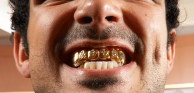 Kevin Milne – Teeth grills