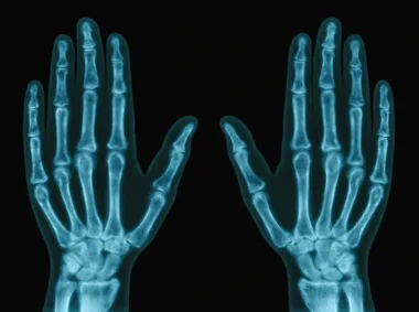 Here’s what actually happens when you crack your knuckles