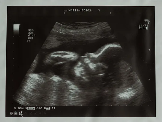 Indian woman gives birth