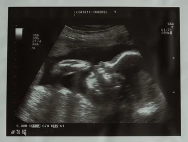 Indian woman gives birth
