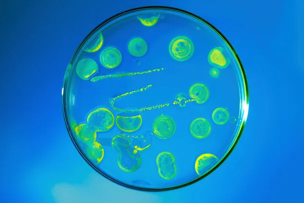 Antibiotics revolution needed to prevent global crisis