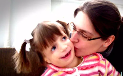 Treacher Collins Syndrome