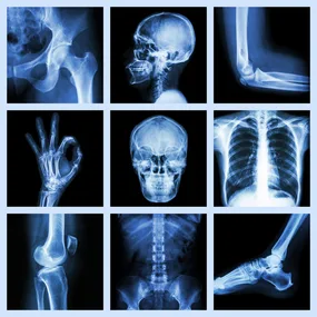Human X Ray