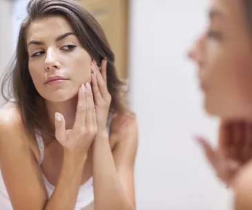 Woman with acne
