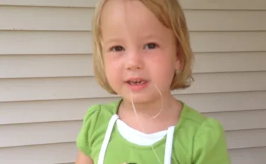 Little girl tooth