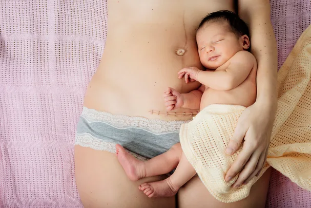 C Section